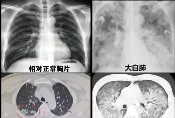 BuffX白芸豆糖全新升级，饭前吃一颗